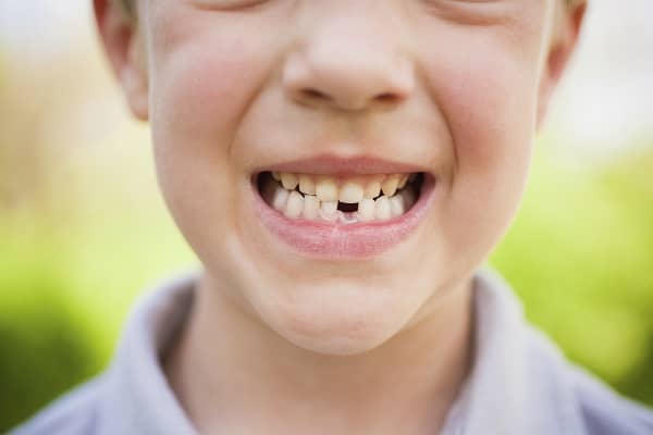 Kid with Missing Tooth